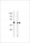 DANRE hoxa1a Antibody (Center)